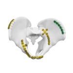 [QWEN_MT_ITEM_1]Kifungu cha Mfuko wa Sacroiliac