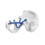 Plati ya Kufungwa kwa Acetabulum ya Pelvis ya Anatomia