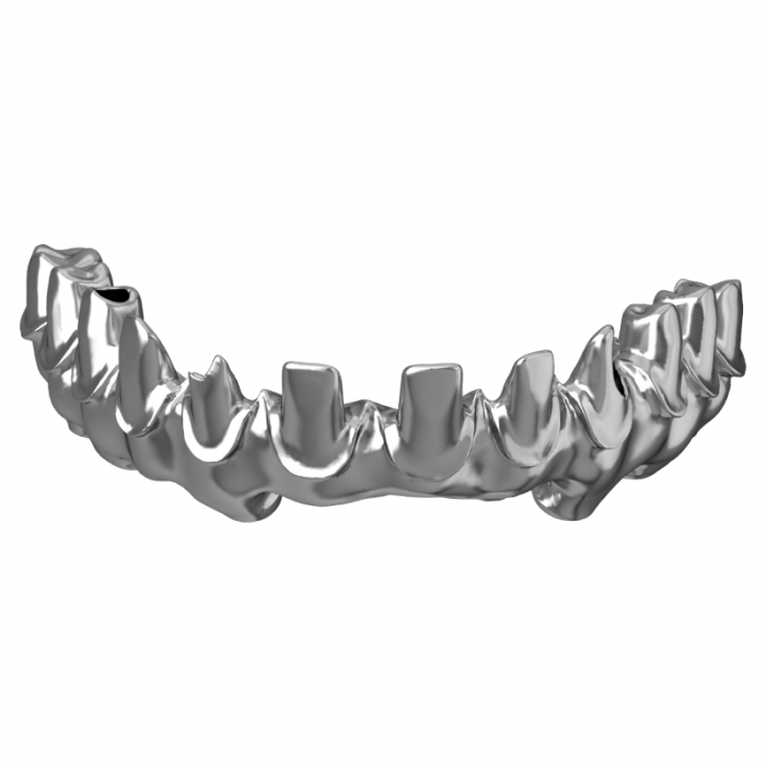 Titanium Implantat Daraja